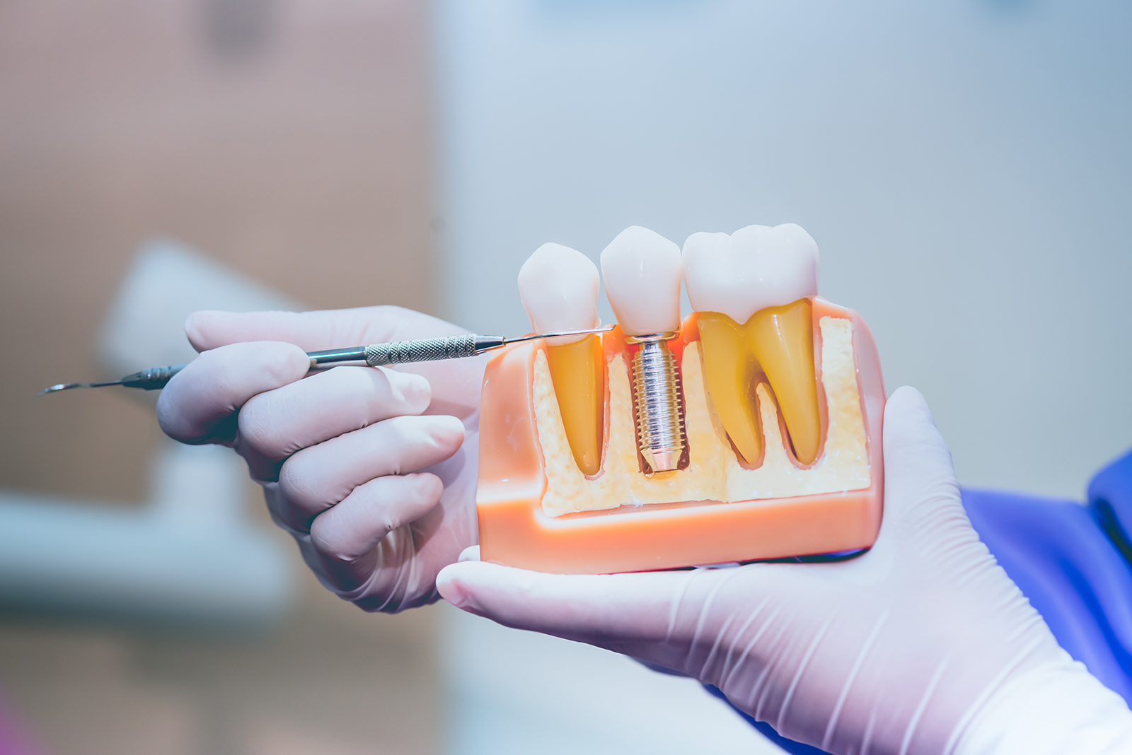 Grand View Dental Clinic | Pediatric Dentistry, Full Mouth Reconstruction and Digital Impressions