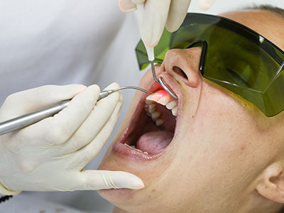 Grand View Dental Clinic | Dental Sealants, Dental Lab and Dermal Fillers